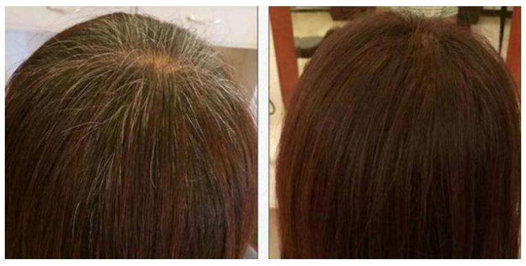 什么植物花能染白头发,纯植物什么花可以染发