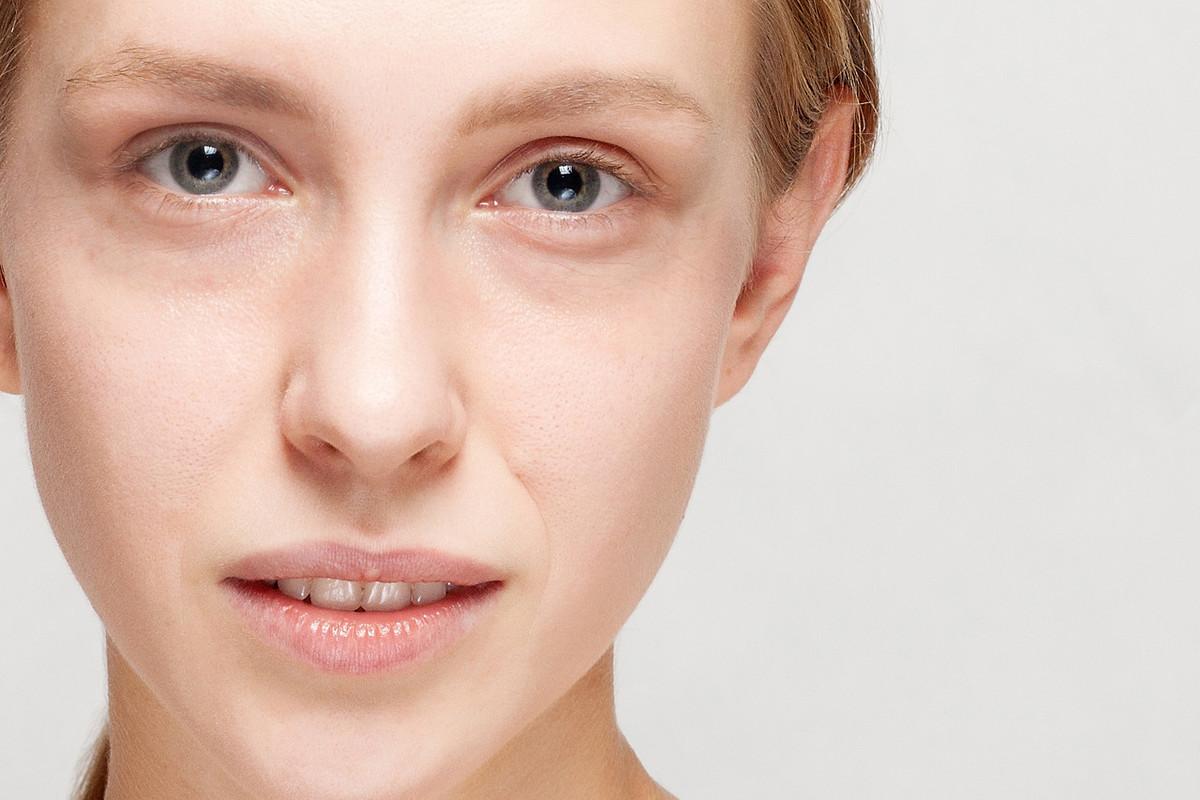 去除黑眼圈男士专用,遗传黑眼圈怎么去除