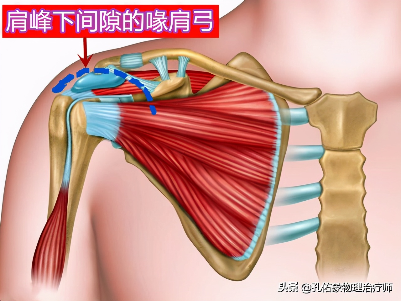 什么原因引起肩周炎手臂活动受限,引起肩周炎疼痛是什么原因