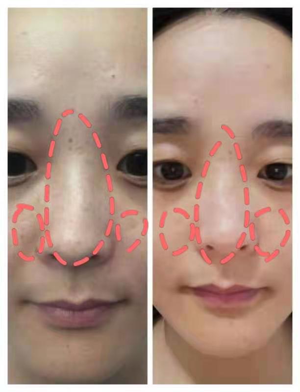 脸上有斑怎么祛斑最快最有效,脸上有斑怎么祛斑最快最有效技巧