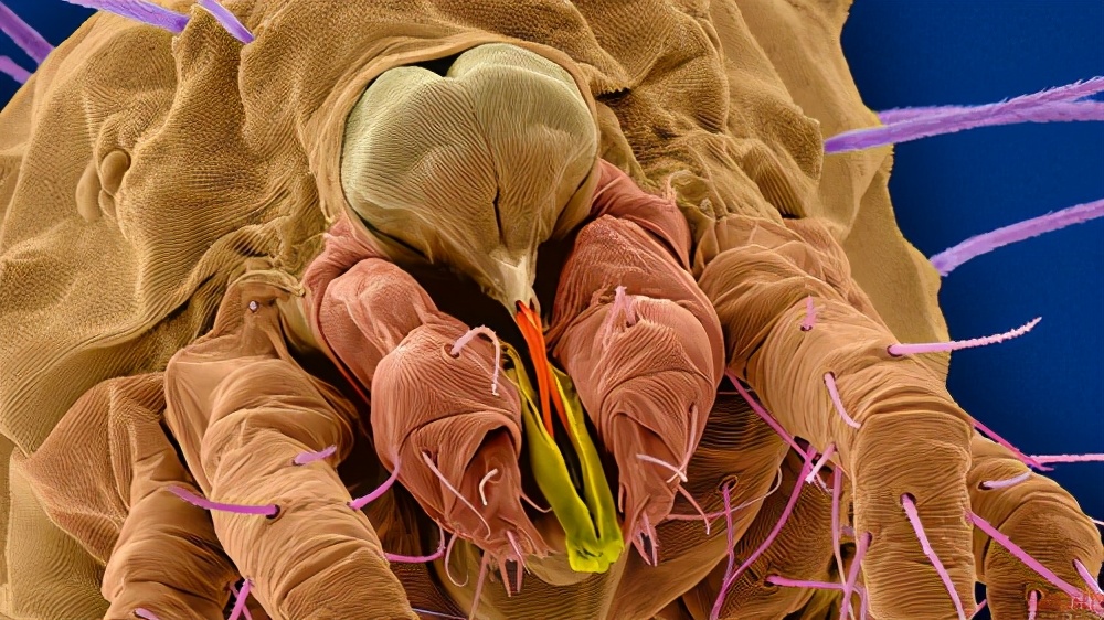 虱子是如何出现的,虱子是怎么存在的