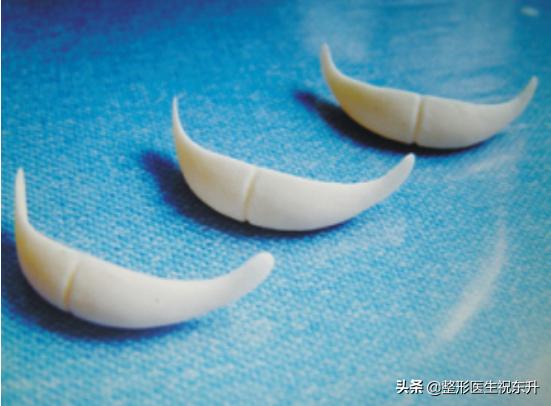 丰下巴的假体需要取出来吗？