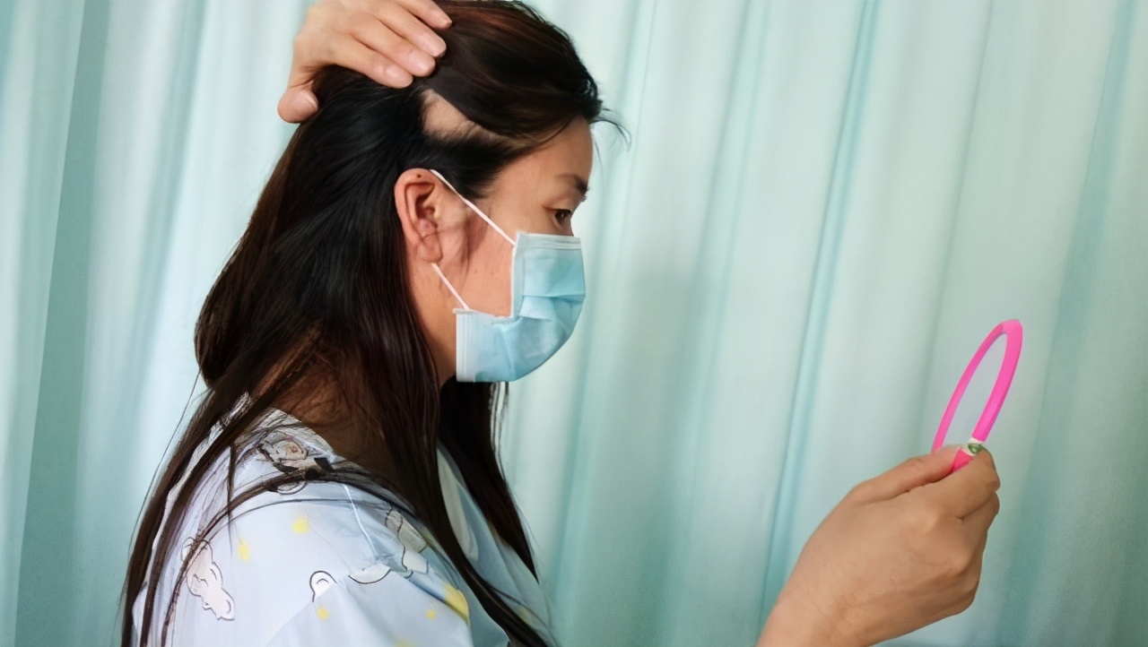 脱发不用愁教你一招改善脱发问题,脱发的原因及治疗方法你了解了吗