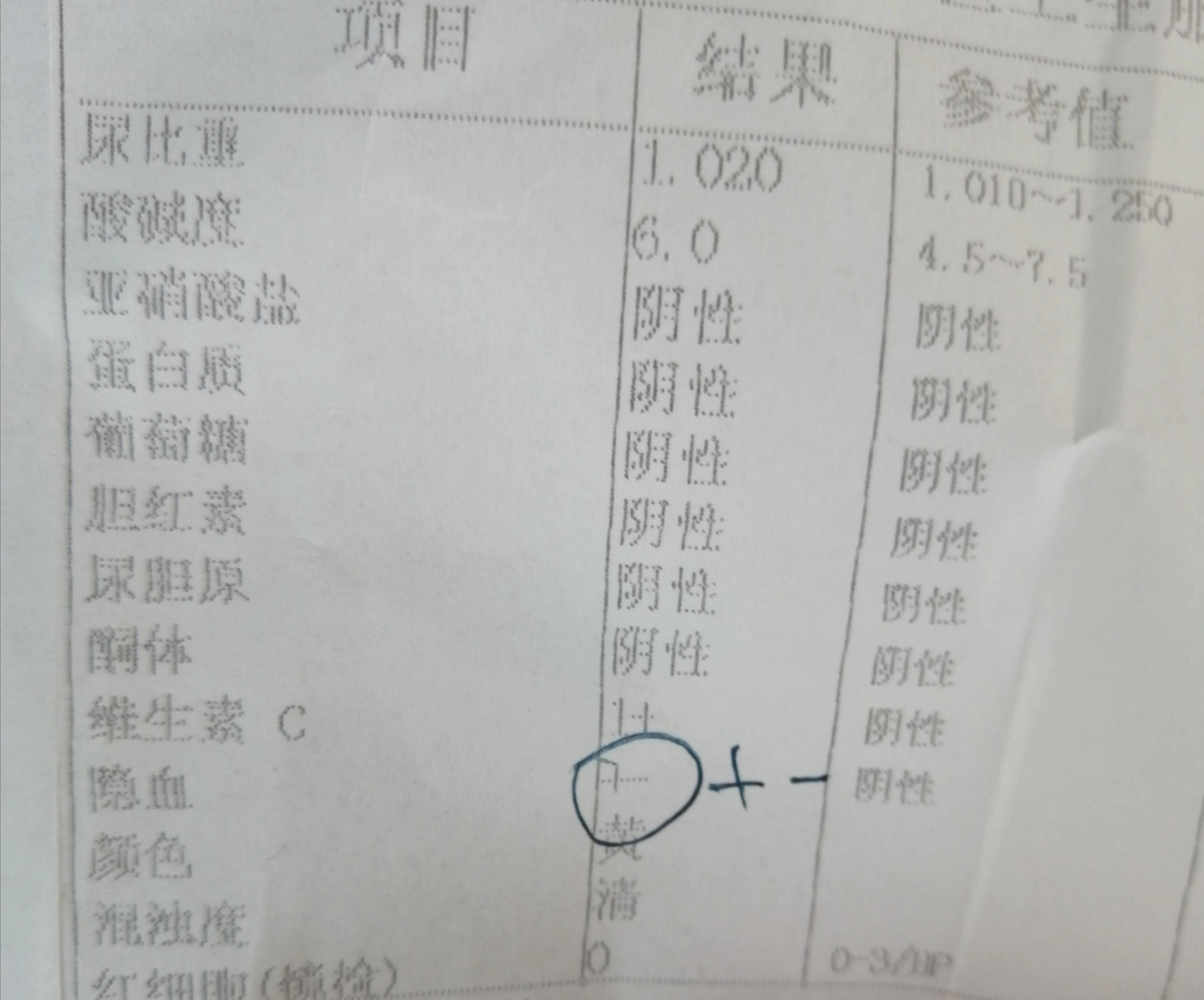 儿童尿隐血1但是其他都正常,儿童尿隐血一个加号