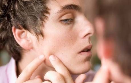 清理黑头最好用的办法,去黑头的最好方法不用清洁