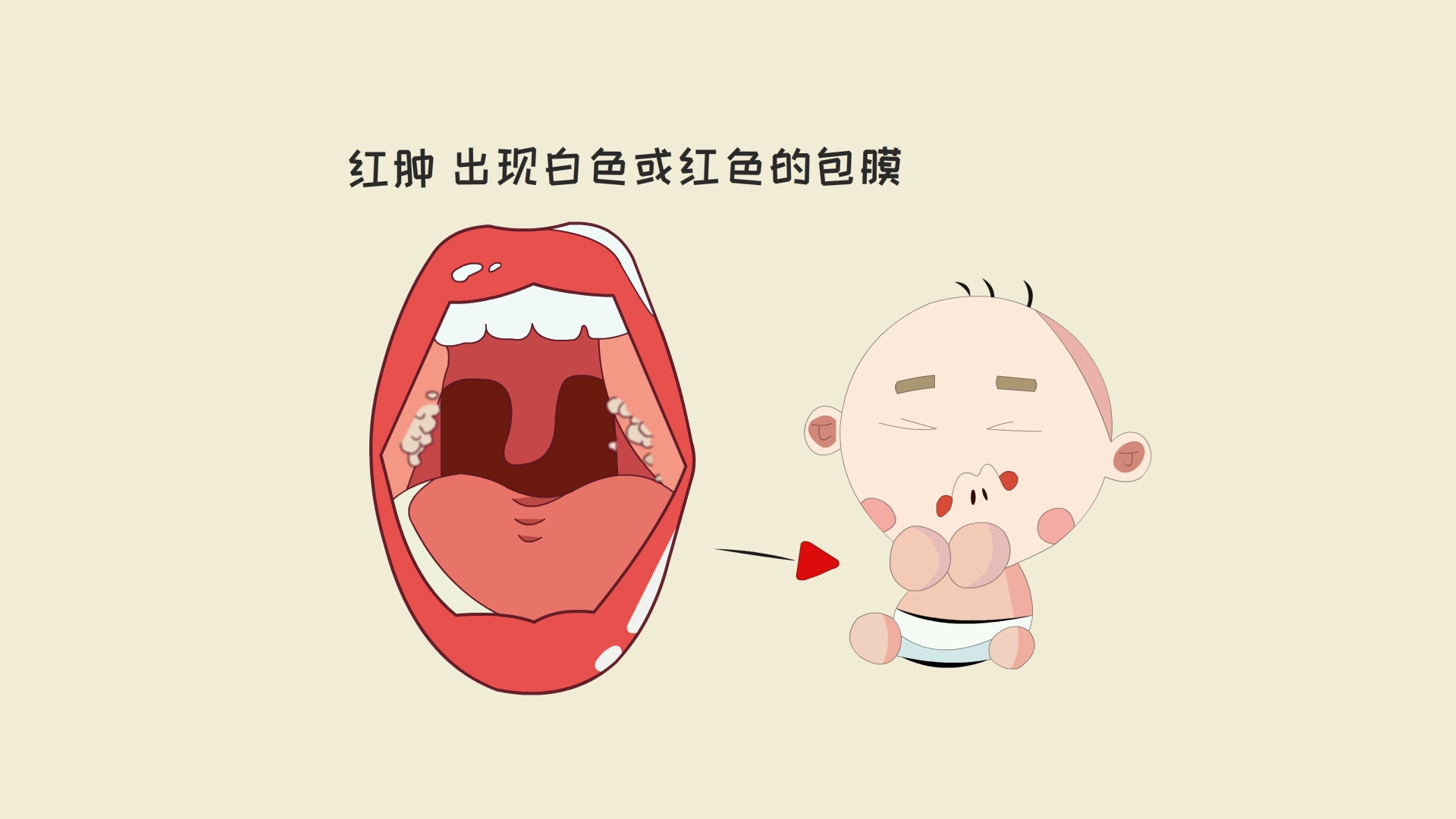 对耳鼻喉科的常见病有所了解,儿科医生家长必读