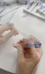 面膜这样敷效果才好补水效果超赞,敷了补水面膜起了很多皮