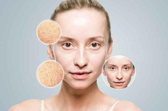 眼圈干燥起皱纹怎么办,皮肤干燥皱纹多怎么办