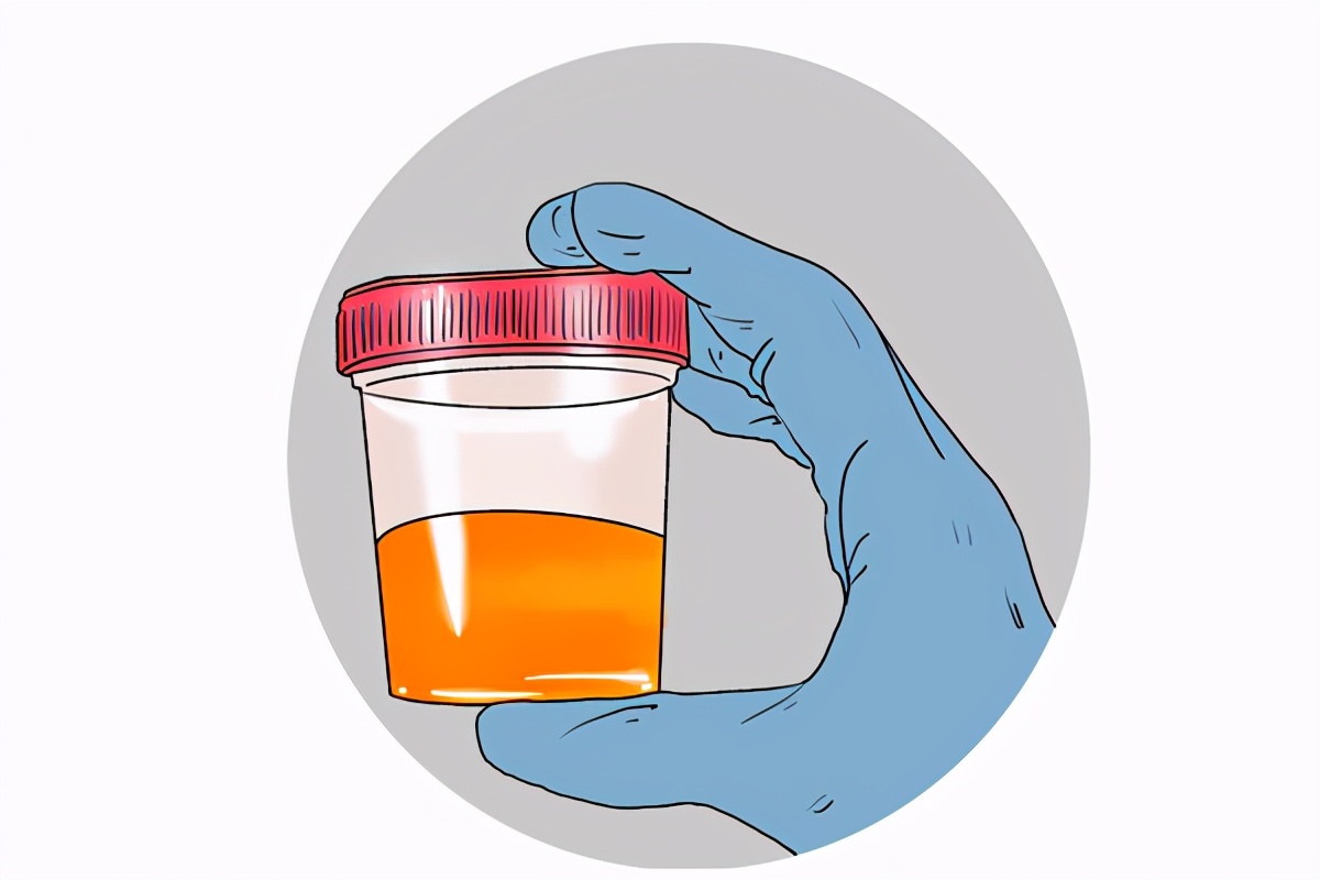 痛风的五个真相让你少走弯路,痛风吃什么才有帮助