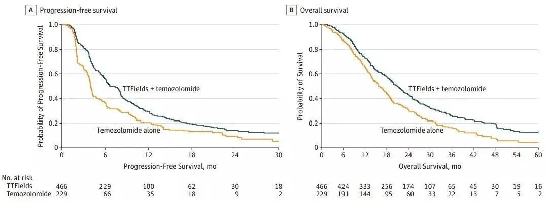 中国肿瘤电场治疗成功案例,爱普新生肿瘤电场治疗