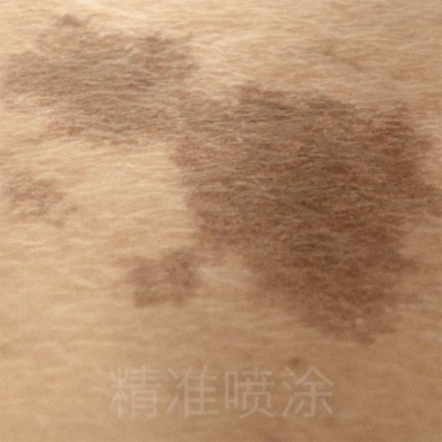 瞬间让脸变白的神器,让斑快速消失