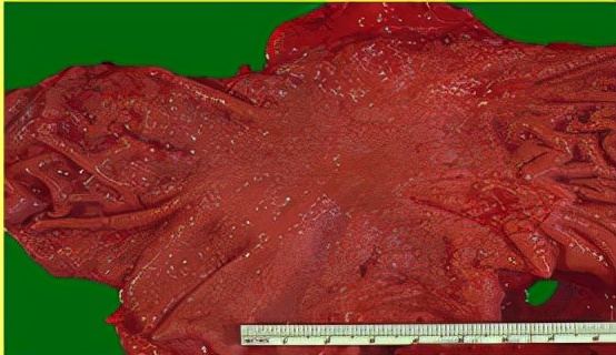 我不是药神，我不是财迷！若患胃癌，这些靶向药你有能力负担吗？