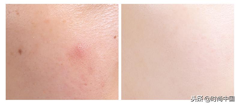 懒女人必备的护肤品,懒女生用的护肤品