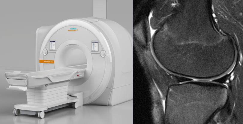 半月板损伤康复训练,半月板损伤膝盖疼的最好治疗方法