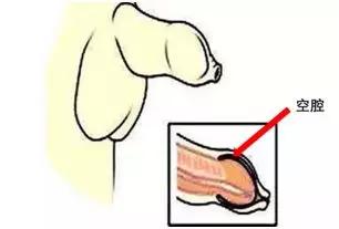 关于包皮包茎疾病的介绍,包茎通俗易懂的解释