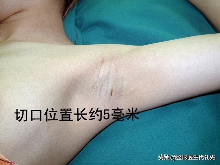 腋臭科普小知识,腋臭科普题目