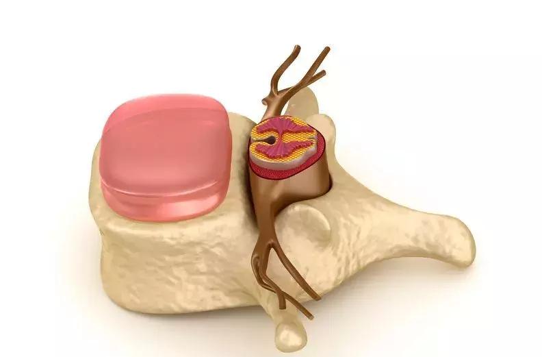 体检查出这10种病基本不用治,华西医院的医生说哪些病不用担心