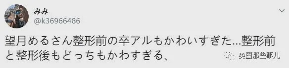 20岁漂亮女子花6万整容鼻子失败,19岁少女花百万整容