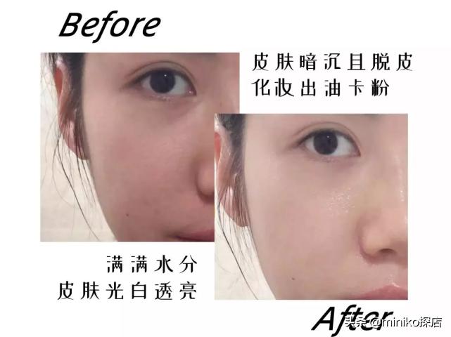 沙漠大干皮敏感肌救星,沙漠干皮救星视频