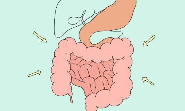 上消化道大出血的急救措施,上消化道大出血的应急演练预案