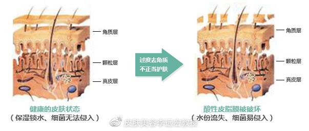 洗脸后脸局部发红是什么原因,洗脸发红发热怎么办