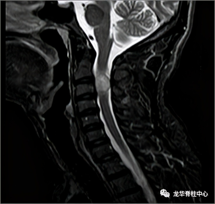 深圳市龙华区人民医院脊柱外科简介
