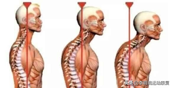 富贵包怎么消除最好方子,富贵包怎么消除视频教学