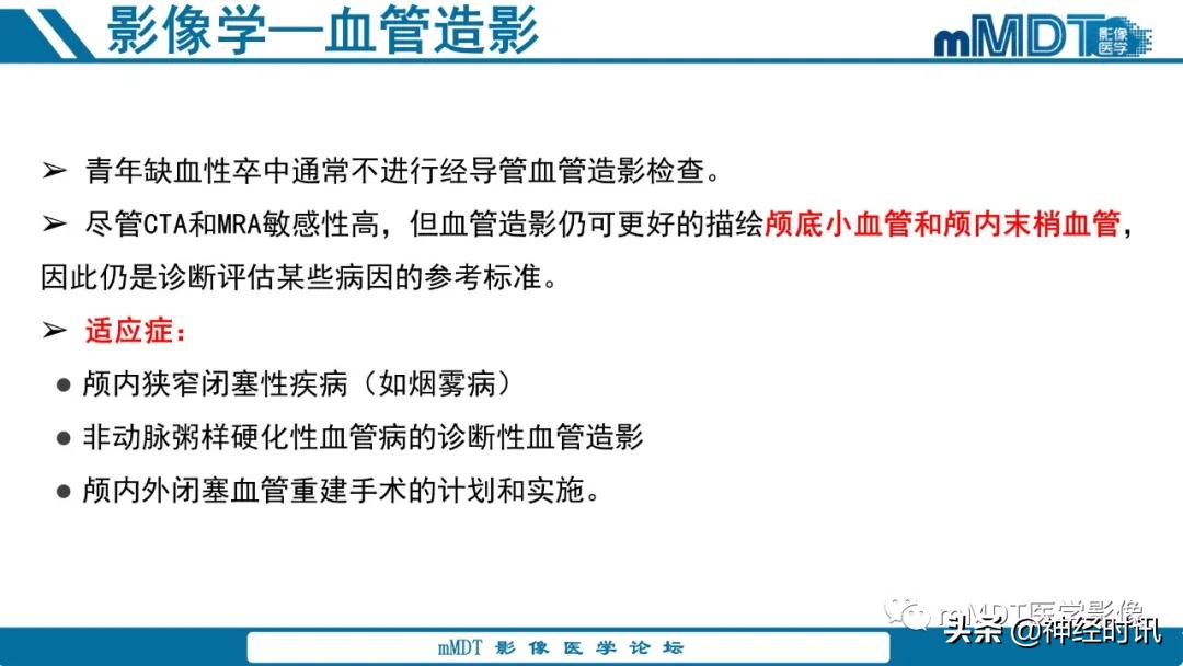 急性缺血性脑卒中ppt素材图片,青年缺血性脑卒中ppt