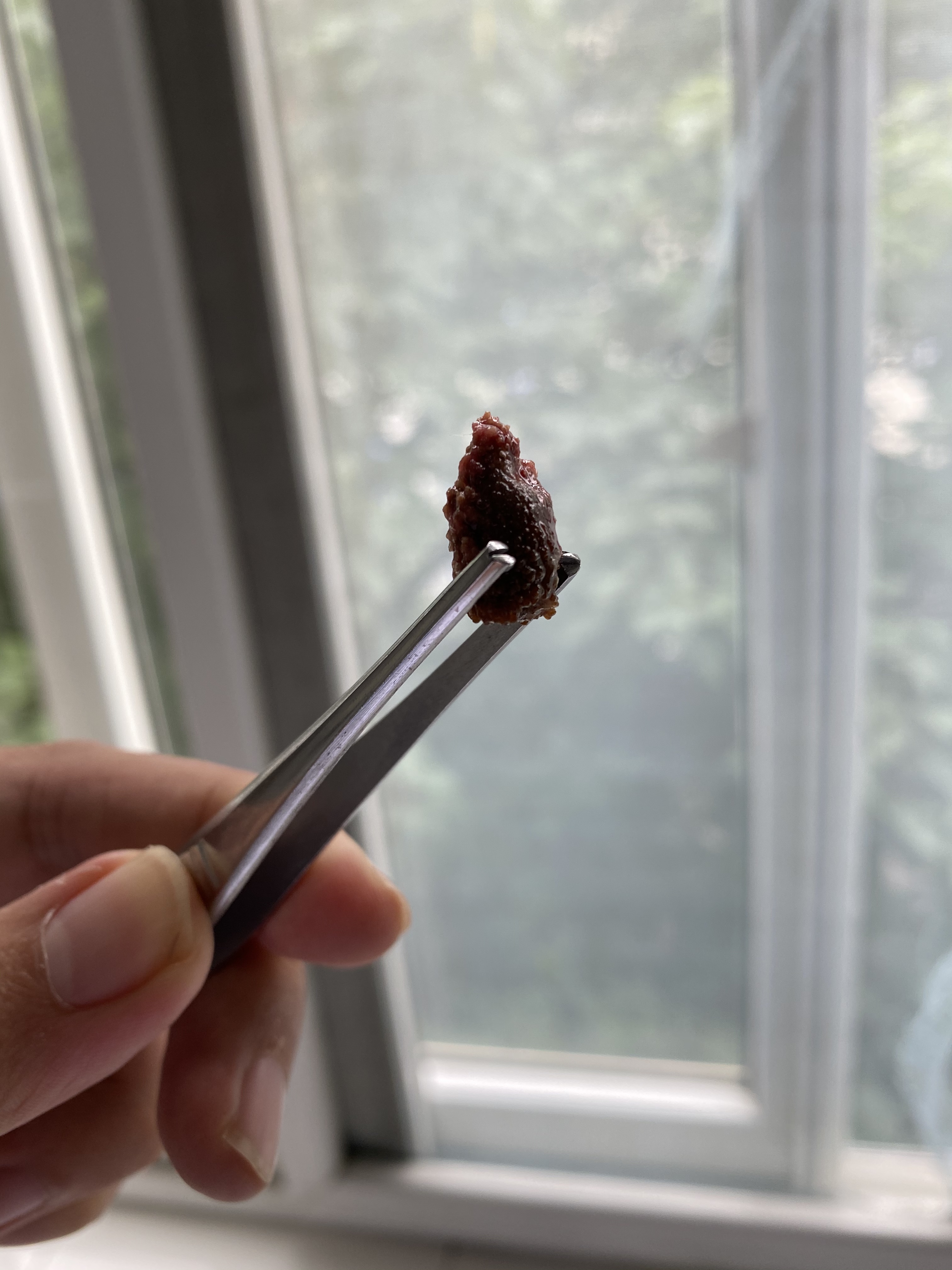 肾结石在尿道怎么快速排出,肾结石到尿道里怎么能快速排出