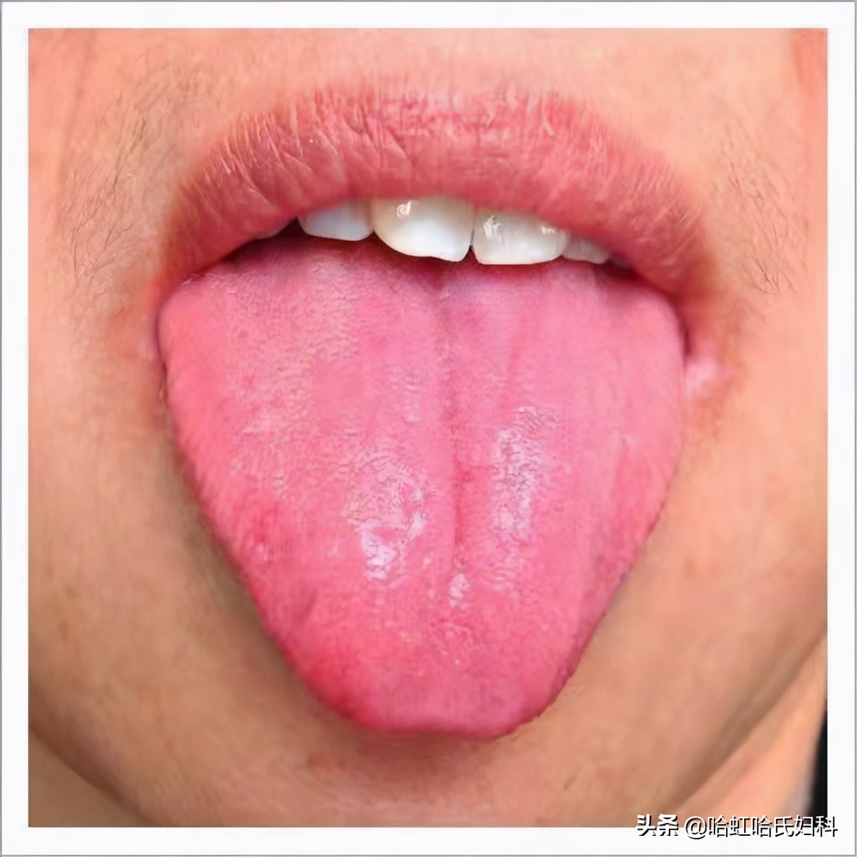 中医的五种方式告诉你是否脾虚,一招教您判断体内湿气