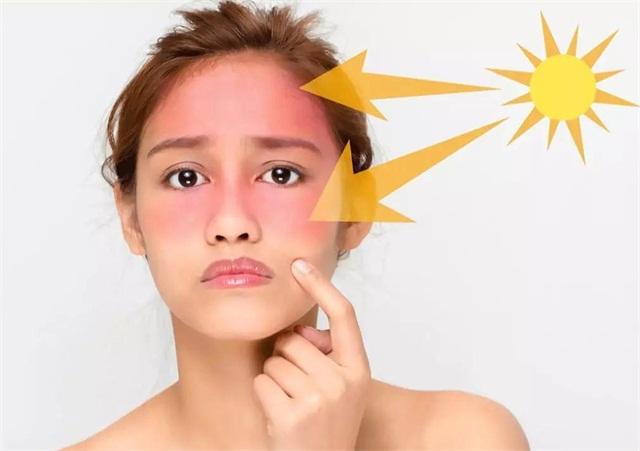 军训晒黑晚上用什么修复,军训晒后修护白天