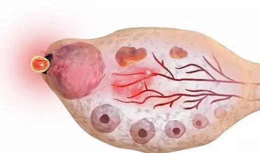 排卵正常就是怀不上？原因可能是这个