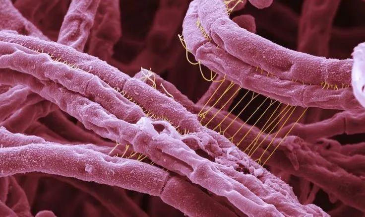 不是药嗑多了，加拿大怎么可能制造出这种“毒器”？｜局器