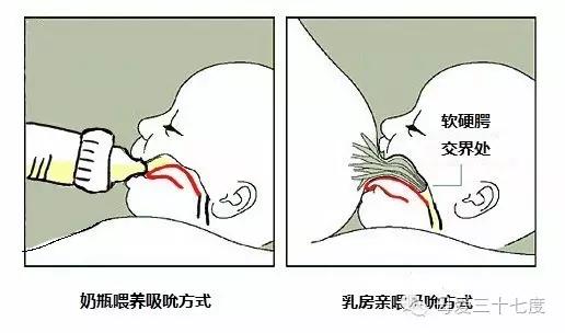 宝宝不爱吃母乳爱吃奶瓶怎么办,婴儿不认母乳只认奶瓶怎么纠正