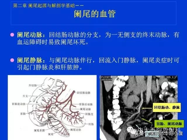 阑尾炎课件,阑尾炎的超声课件