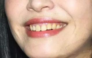 盘点全球9款真正好用的人气牙膏,牙膏界顶流炫白牙膏