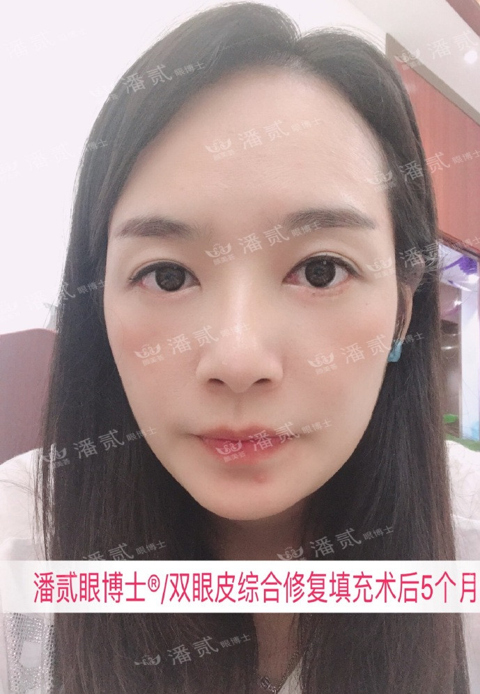 <html>
<head><title>502BadGateway</title></head>
<body>
<center><h1>502BadGateway</h1></center>
<hr><center>nginx</center>
</body>
</html>
<!--apaddingtodisableMSIEandChromefriendlyerrorpage-->
<!--apaddingtodisableMSIEandChromefriendlyerrorpage-->
<!--apaddingtodisableMSIEandChromefriendlyerrorpage-->
<!--apaddingtodisableMSIEandChromefriendlyerrorpage-->
<!--apaddingtodisableMSIEandChromefriendlyerrorpage-->
<!--apaddingtodisableMSIEandChromefriendlyerrorpage-->
