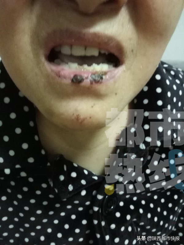 老人步行过马路被车撞谁的责任,老人过马路被撞身亡后续怎么处理