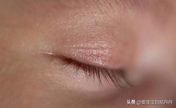 眼屎糊住眼睛睁不开小孩,宝宝眼屎多眼睛睁不开怎么擦掉
