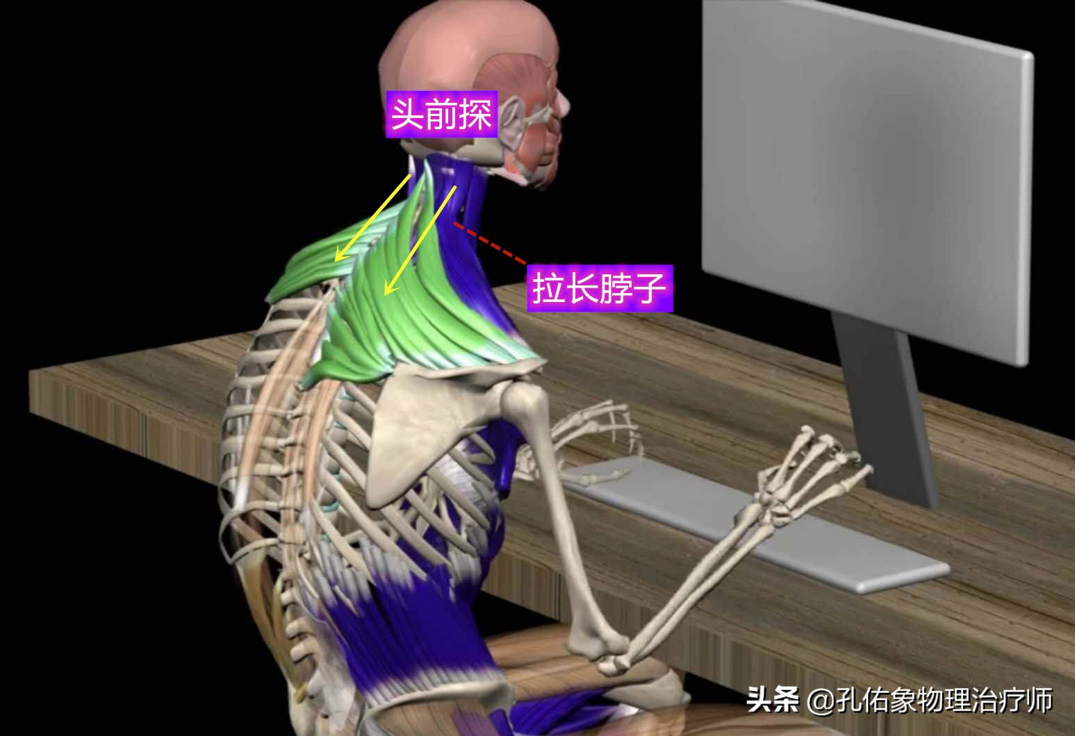 为什么颈肩部肌肉酸痛,肩颈疼痛严重解决最好办法