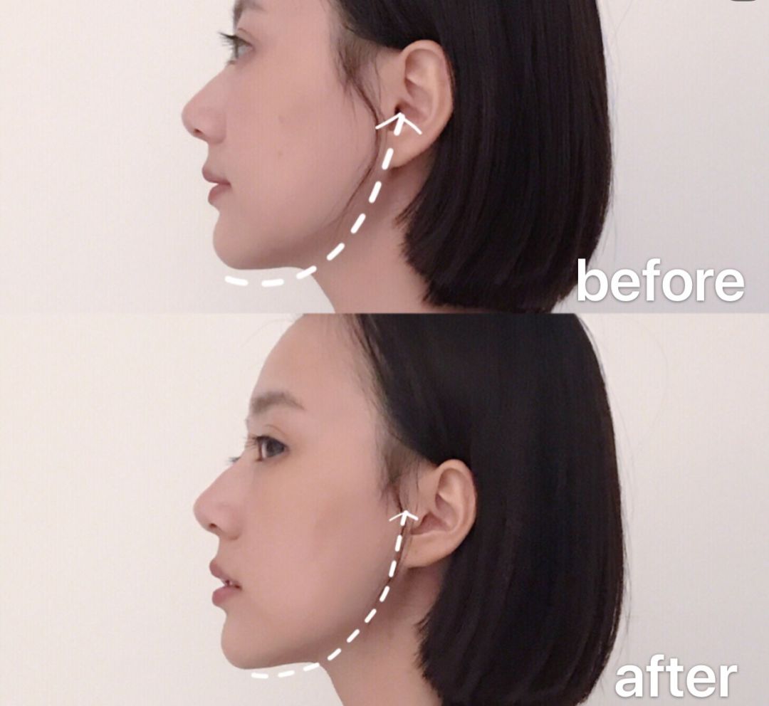 雅萌美容仪m10tplus冰敷,雅萌美容仪m20和m10效果一样吗