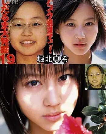 日本整容惊人案例,日本整容是不是最先进