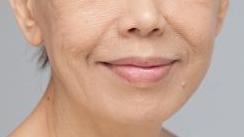 抬头纹鱼尾纹法令纹哪个更显老,抬头纹鱼尾纹法令纹颈纹一样没少