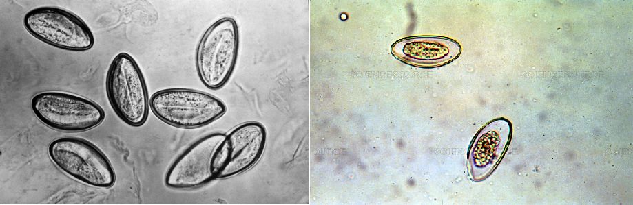 现在小学生要打虫吗,给小孩打虫的季节