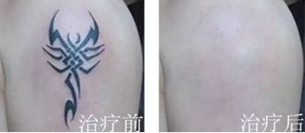 清洗纹身一般要几次,清洗纹身后需要注意什么