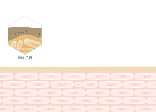 红痘印和红痘痘怎么祛,祛痘疤痘印痘坑最有效的方法