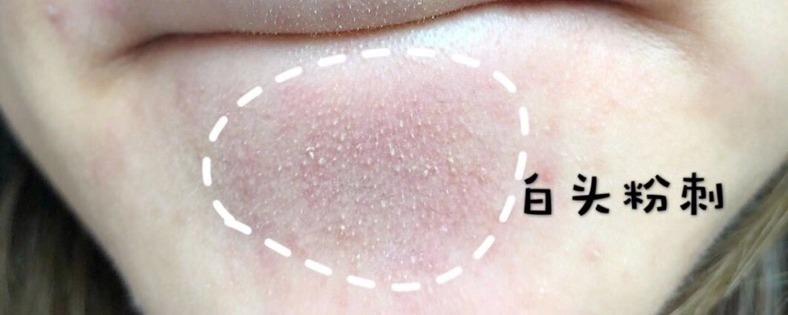 你以为的闭口不一定是闭口,你以为的直言不讳其实是口无遮拦