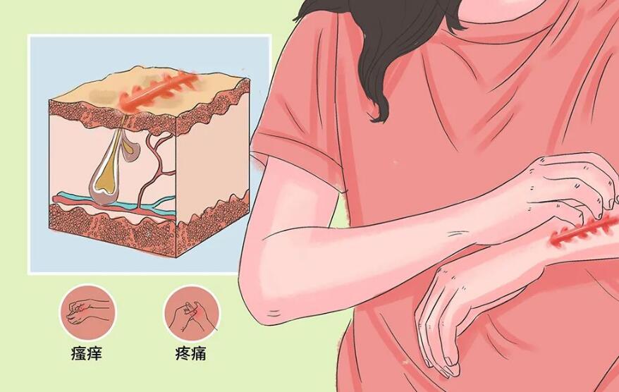 洗澡的时候搓下来的黑泥放大100倍,搓澡下来的黑泥是什么显微镜