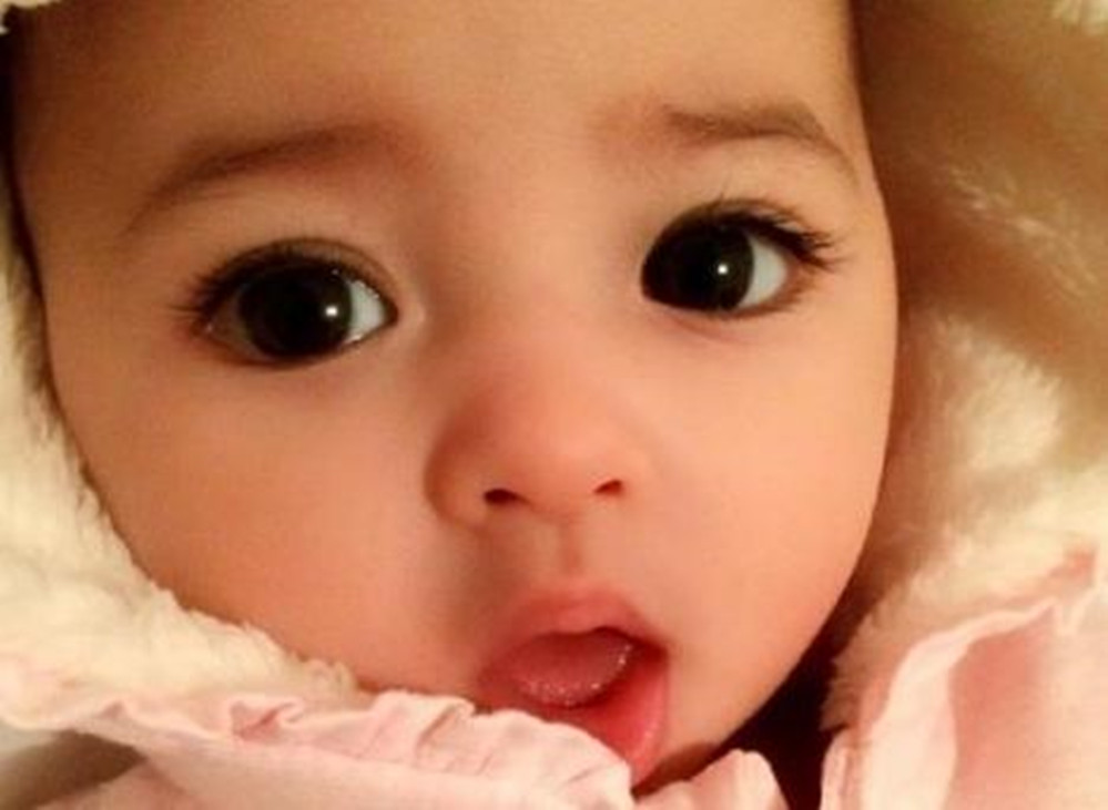 30天宝宝豆豆眼是什么原因造成的,宝宝长痘痘和妈妈饮食有关吗