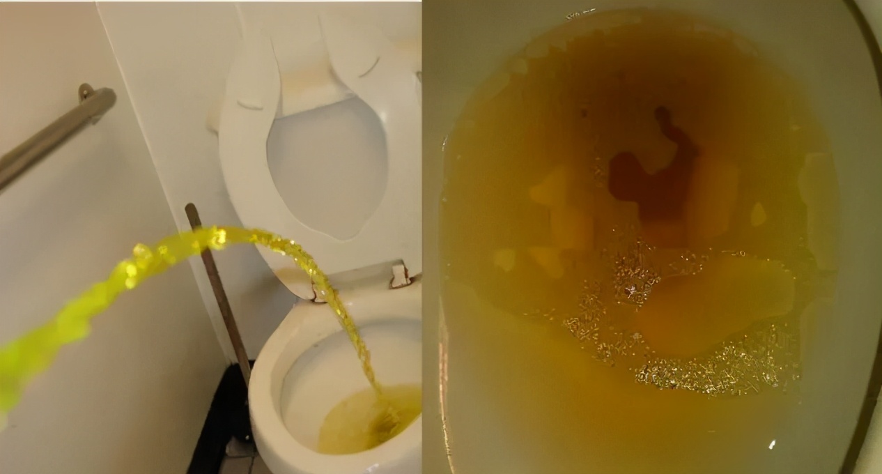 身上长了红色的蜘蛛点怎么回事,身上有蜘蛛红点